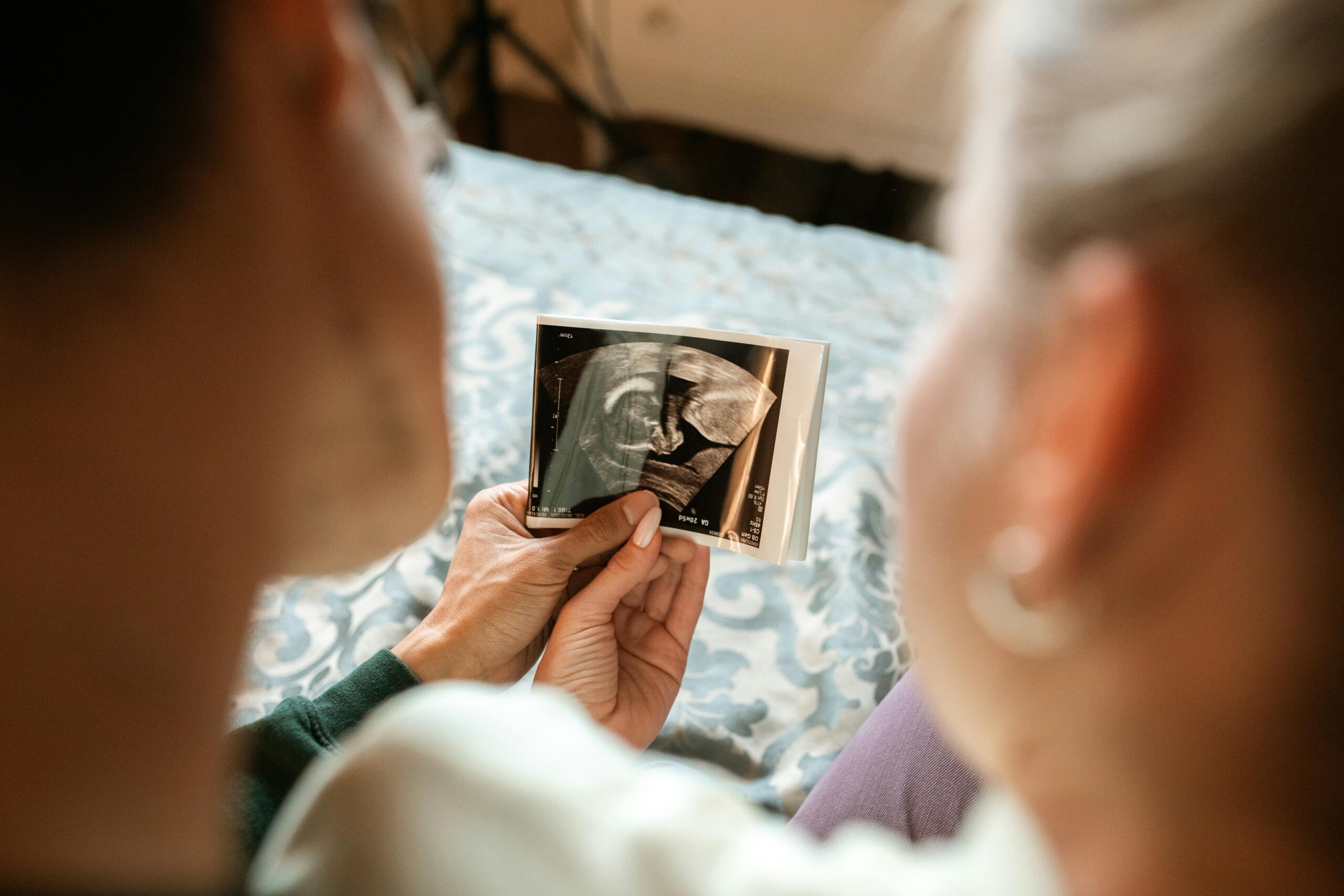 How Stress Impacts Fertility